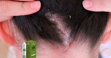 CBD cream Psoriasis – крем от псориаза
