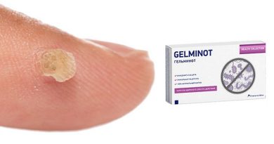 Gelminot от папиллом и бородавок: профилактика и лечение любых новообразований на коже!