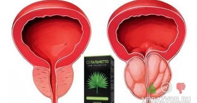 Со Пальметто – препарат для лечения простатита
