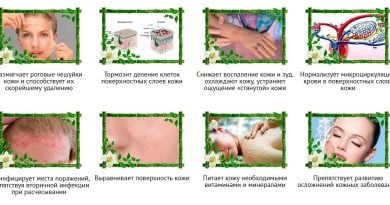 Супер Псори крем для эффективного лечения псориаза!
