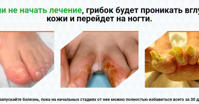 Mikocin