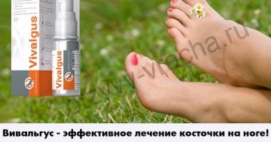 Вивальгус — убираем косточку за месяц
