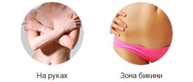 Препарат Stop Grow простив роста волос