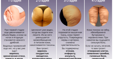 Крем Антицеллюлит Extreme Антицеллюлит Экстрим от целлюлита — Ваш помощник в борьбе за идеальную фигуру